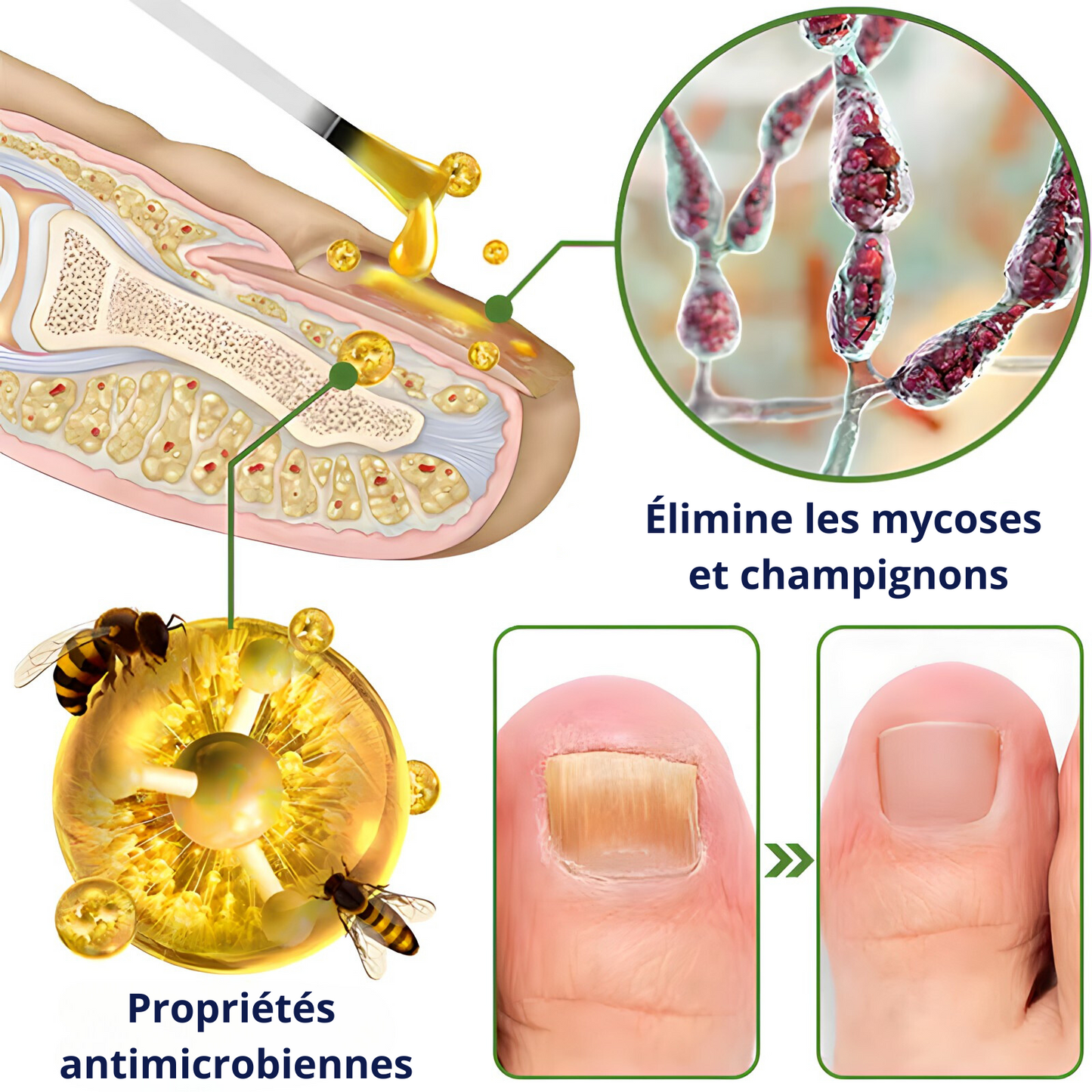 Sérum ongles au venin d’abeilles